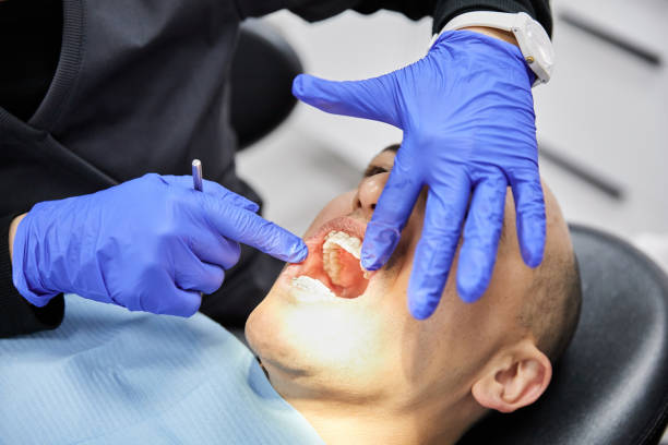 Best Chipped Tooth Repair Near Me  in Bishop, TX